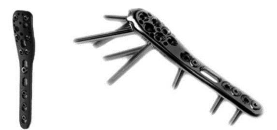 Placa para fixação das fraturas do ombro (úmero proximal)