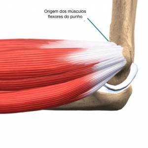 Epicôndilo medial, origem dos músculos flexores do punho e dedos